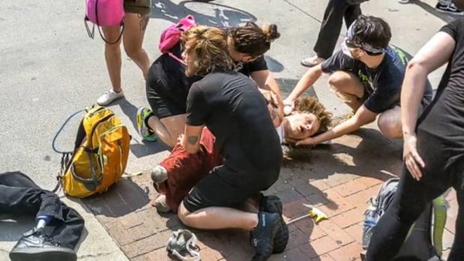 A double amputee was seen writhing in pain after he was allegedly pepper-sprayed by police in Columbus, Ohio. Photo / Twitter
