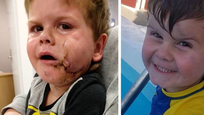 Maxin Bennett immediately after (left) and shortly before the attack. Photos / Supplied