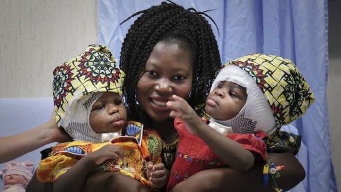 Ermine Nzotto holds her twins Ervina and Prefina Bangalo, at the Vatican pediatric hospital, in Rome, Italy. Photo / AP