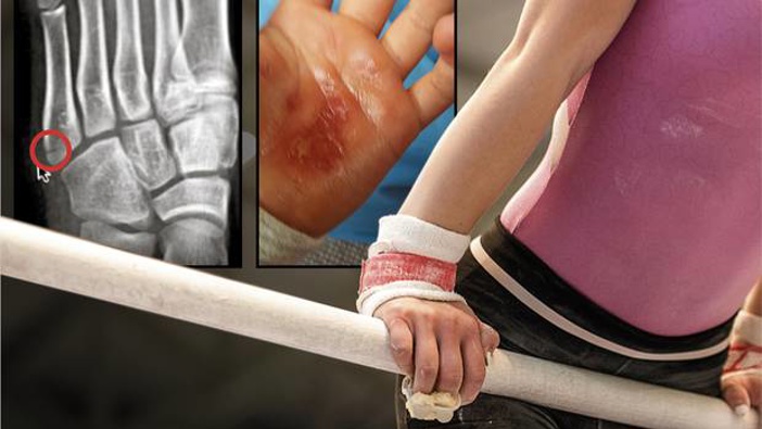 Parents' previous concerns included an athlete being told to continue with a serious foot injury and a girl being forced to train on the bar even after skin on her palms had been torn off. Photos / Getty Images, Supplied