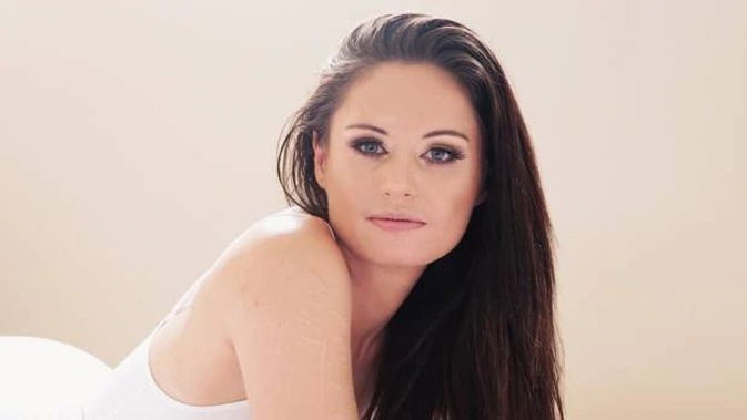 Chanelle Haffenden's book is called 'The Girl with One Thousand Scars'. Photo / Supplied