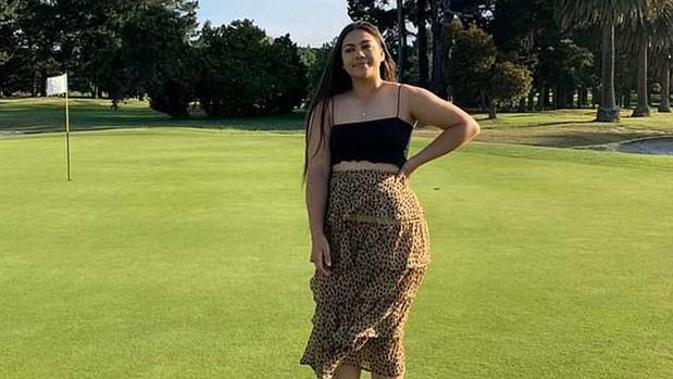 Horrifying images show the nasty burns Aareta Mohi suffered after she spilt a scorching hot coffee on her hands at McDonald's. Photo / Facebook