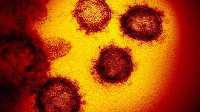 Study by UK scientists has revealed Covid-19 can survive on fabrics for up to three days. Photo / file