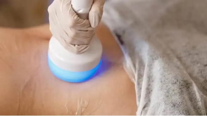 Thermal shock lipolysis is used to decrease fatty deposits in unwanted areas.
