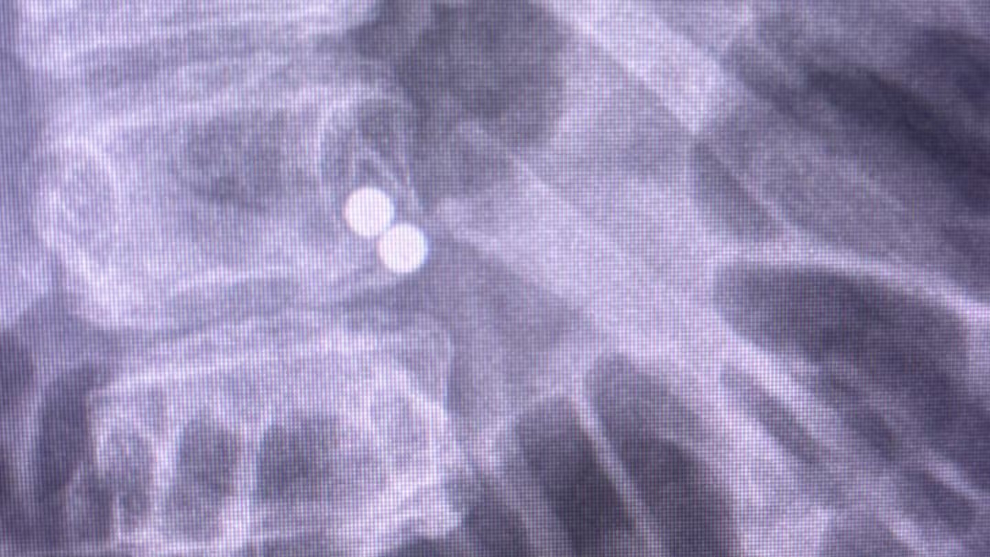 Temu says it cannot verify if magnets consumed by a 13-year-old were sold on its site.