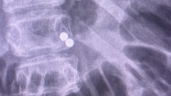 Temu says it cannot verify if magnets consumed by a 13-year-old were sold on its site.