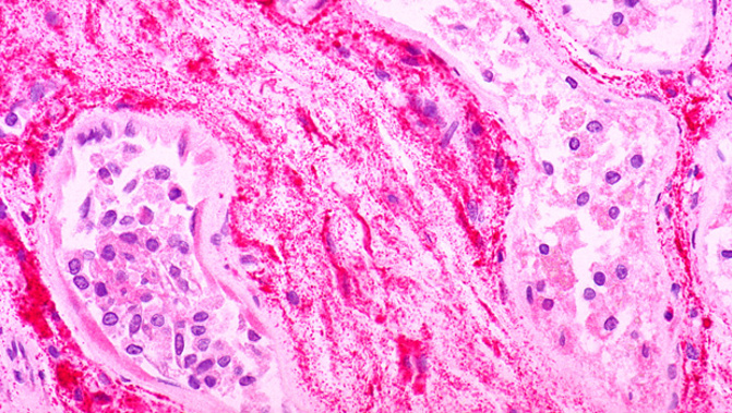 Ebola virus antigen (Getty Images)