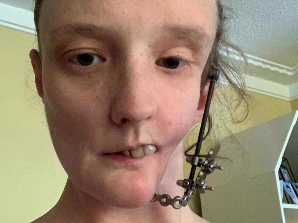 Brittany Kremers. Photo / givealittle