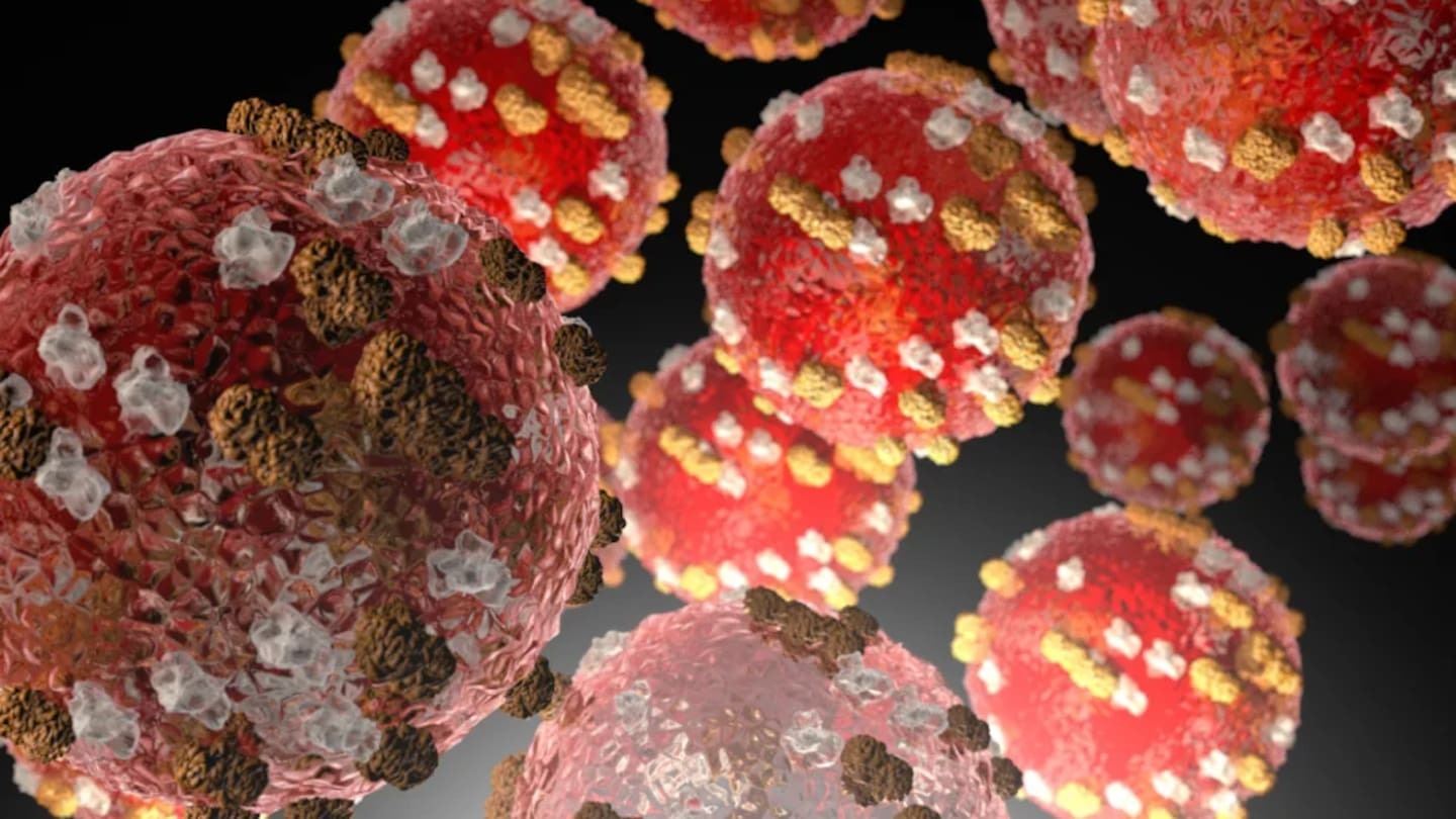 Measles outbreak: Hundreds of close contacts at Wellington school as cases rise