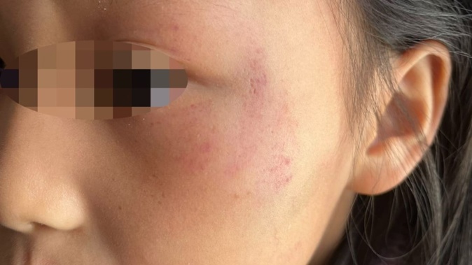 The child said a teenager locked her into the bathroom and started attacking her.