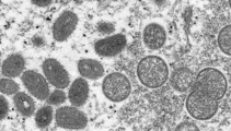 Monkeypox in NZ: Third case confirmed