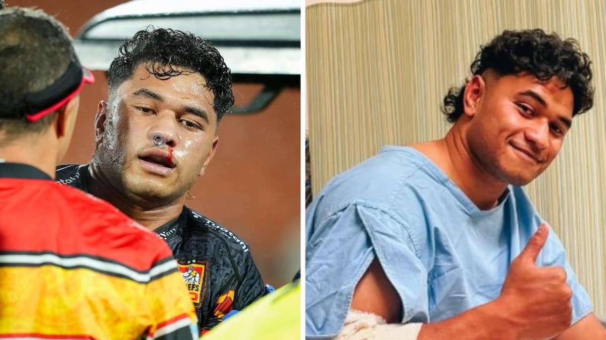 Wallace Sititi recovering well after heavy head knock in Chi