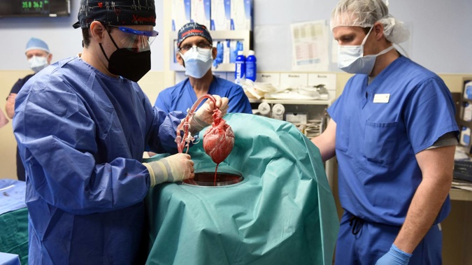 Members of the surgical team show the pig heart for transplant into patient David Bennett in Baltimore last week. Photo / University of Maryland School of Medicine / AP