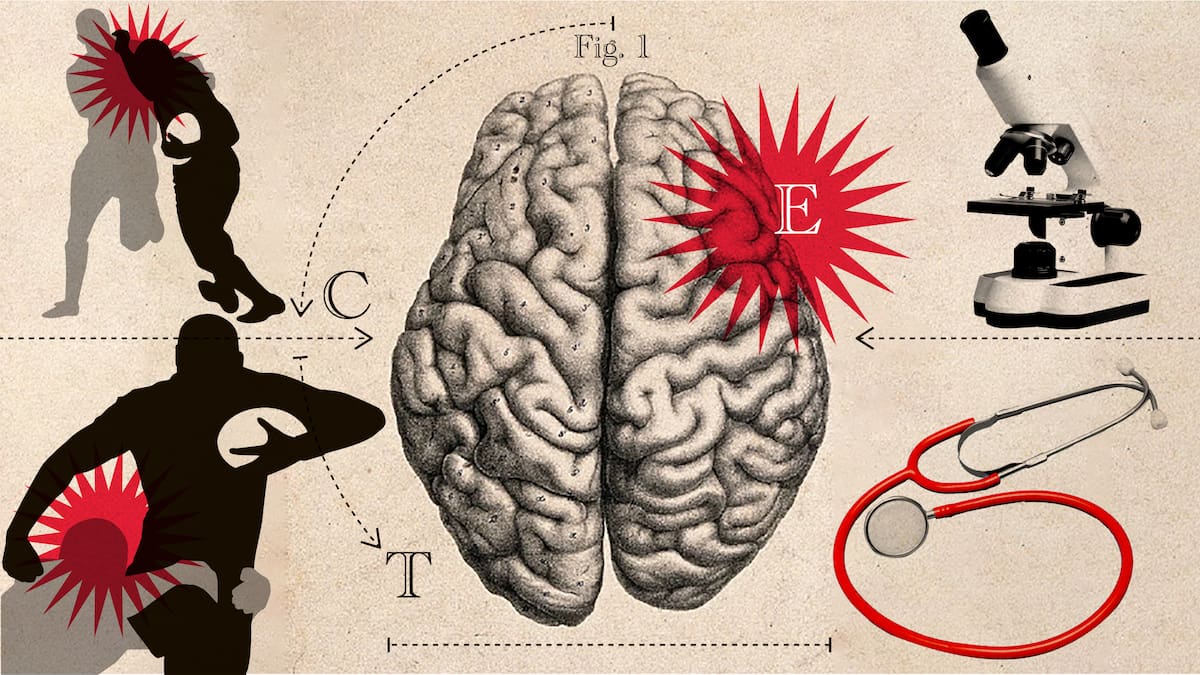 Clare de Lore on the launch of the new 'Brainstorming' podcast