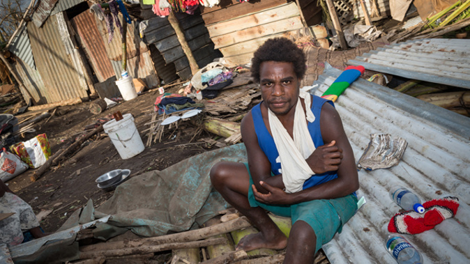 A young man in Vanuatu who was injured during Cyclone Pam. (NZDF) 