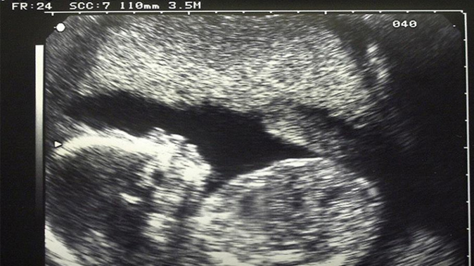 The petition calls for "fully informed consent" from parents. (Photo: Getty Images)