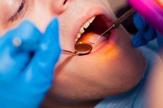 Residents in a rural town are pulling out their own teeth because of long appointment wait times. (Photo / 123rf)