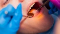 Biting issue: Rural Kiwis ‘resort to pliers’ over seeing dentist