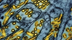 This colorized electron microscope image released by the National Institute of Allergy and Infectious Diseases on March 26, 2024, shows avian influenza A H5N1 virus particles (yellow), grown in Madin-Darby Canine Kidney (MDCK) epithelial cells (blue). Photo / CDC/NIAID via AP