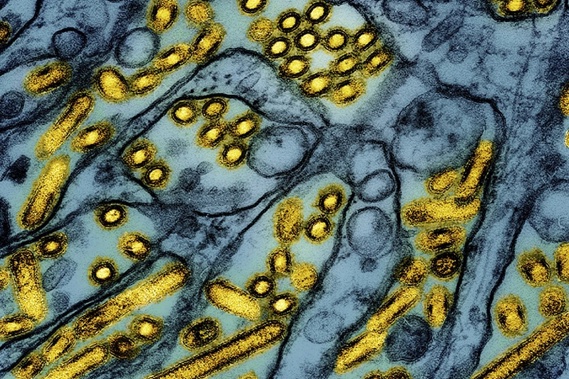 This colorized electron microscope image released by the National Institute of Allergy and Infectious Diseases on March 26, 2024, shows avian influenza A H5N1 virus particles (yellow), grown in Madin-Darby Canine Kidney (MDCK) epithelial cells (blue). Photo / CDC/NIAID via AP