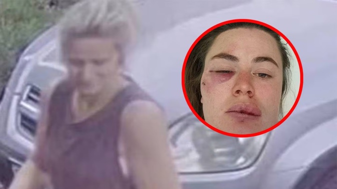 An item of interest has been found in the search for missing Victoria mum Samantha Murphy. Meanwhile, a woman who was attacked while out running in the same region has also come forward.