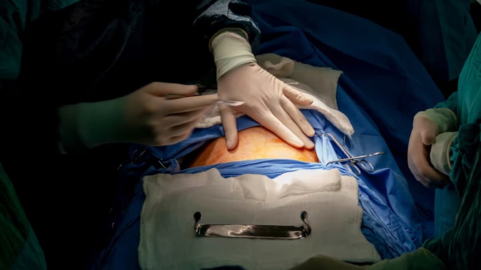 The operation was delayed because the operating theatre was in use. Photo / 123RF