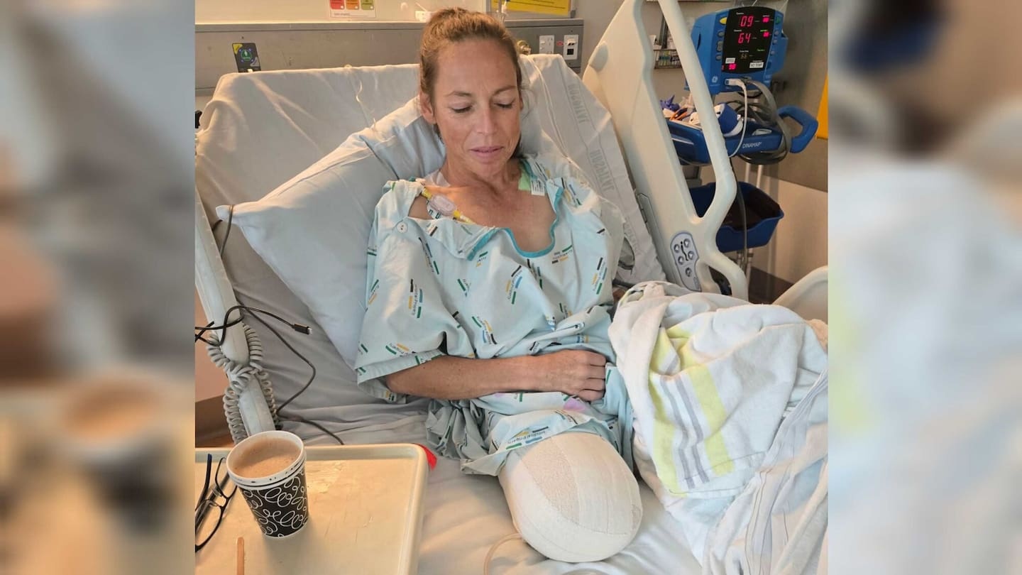 'Time is what I am after': Mum has cancerous leg amputated in bid to extend her life