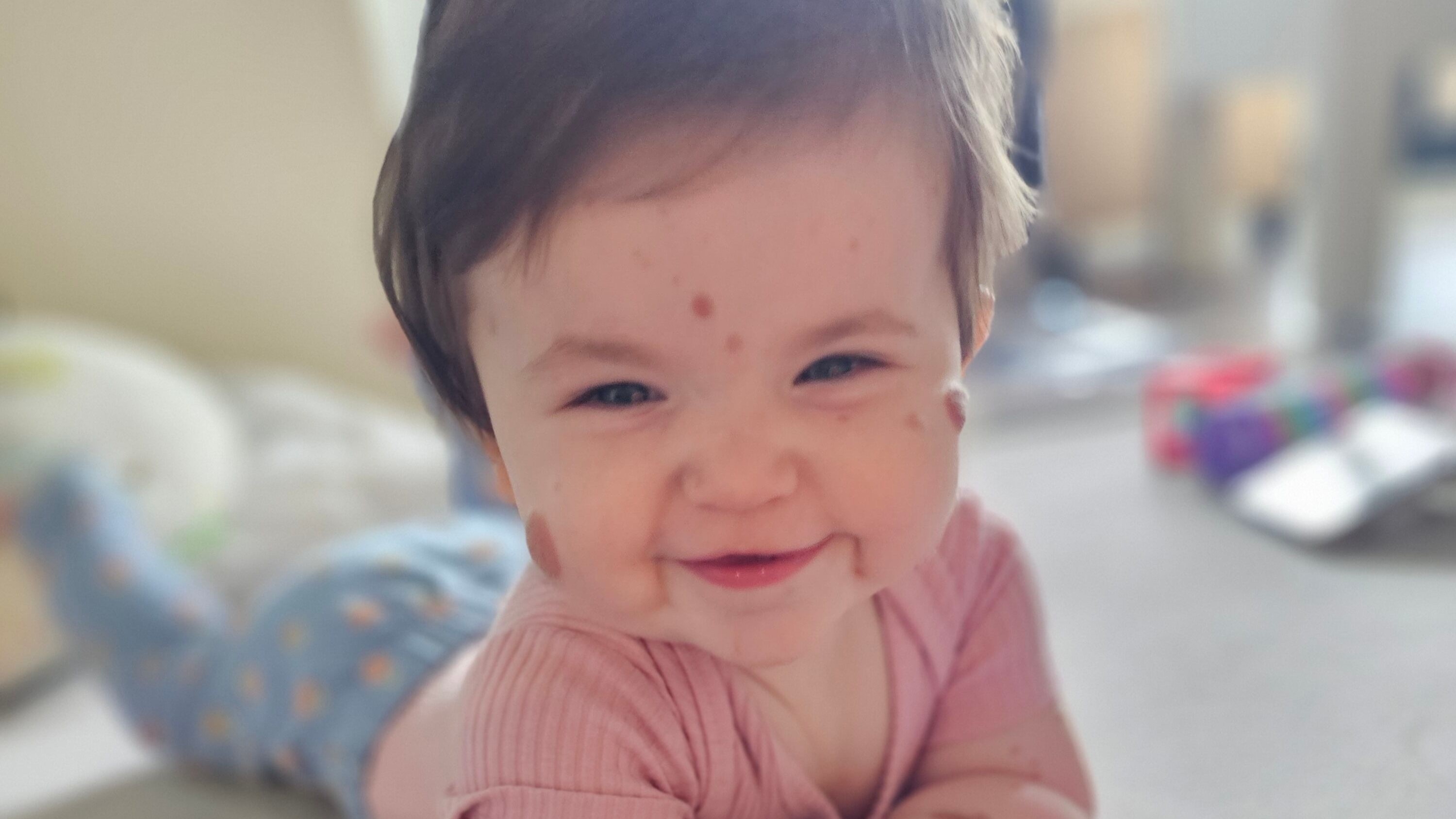‘We don’t know what’s to come’: Baby Livi’s battle with ultra-rare disease