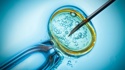 Andrew Murray: Alabama's IVF ban is the 'beginning of a worrying trend in the US'