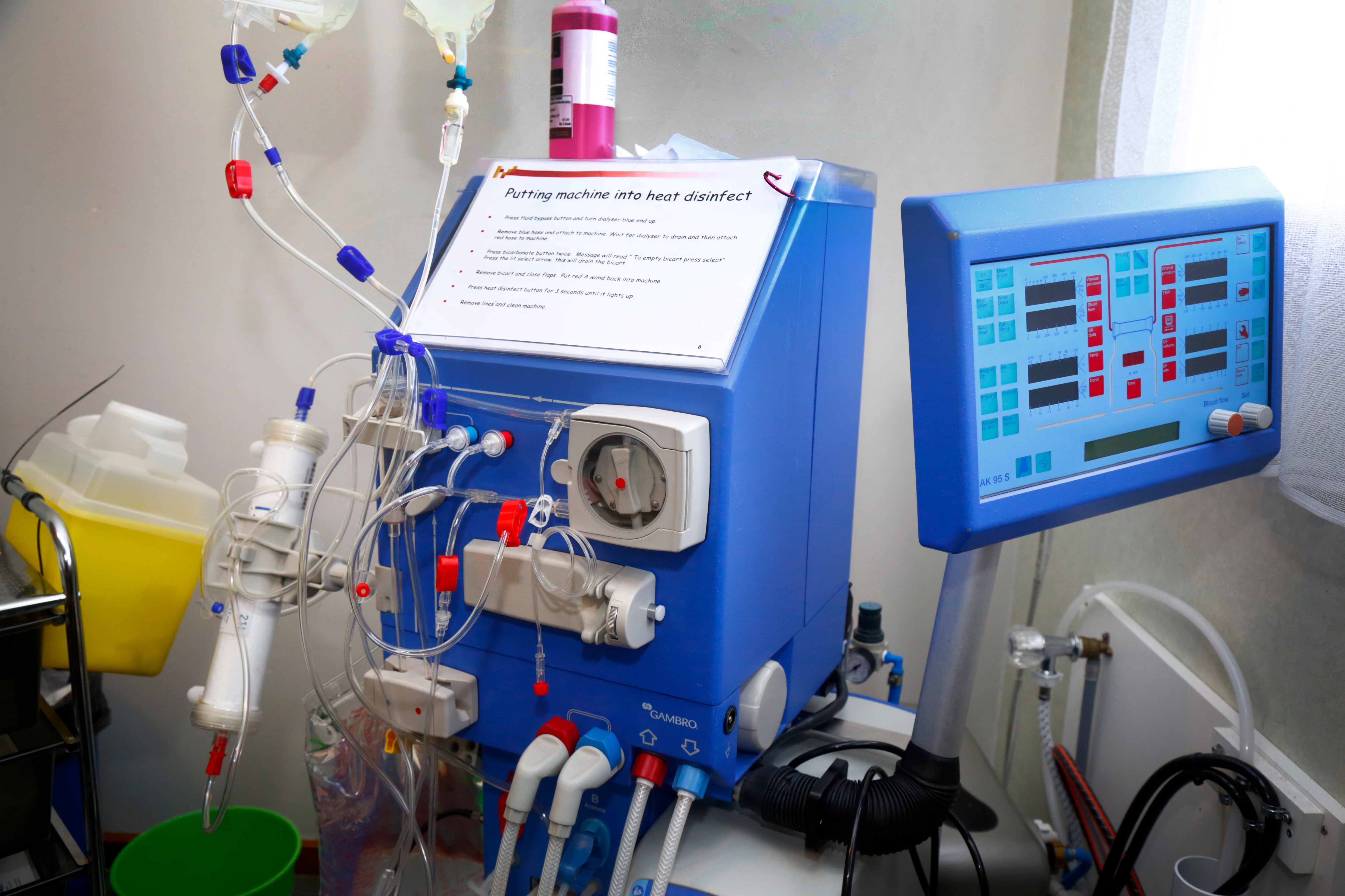 Advocates worry over underfunding of life-saving kidney care