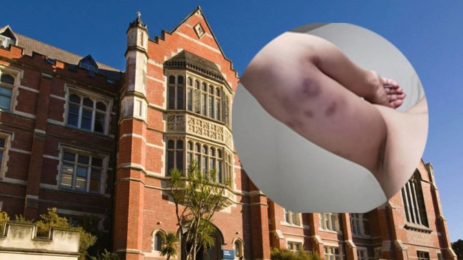 The student says she was assaulted by a Victoria University lecturer after the pair began a relationship.