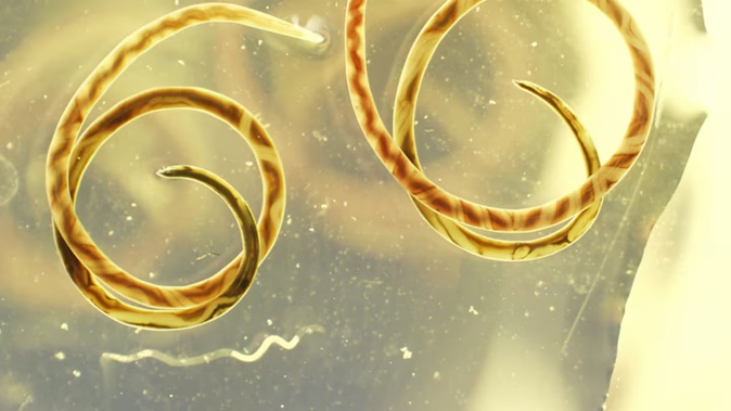 Rat lungworm parasite. Photo / Centres for Disease Control and Prevention