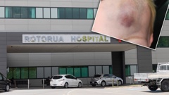 Charnelle Burrows' three-year-old son waited five hours to be seen at Rotorua Hospital ED after he hit his head twice in two separate incidents at his daycare on February 25. Photo: Andrew Warner / Supplied