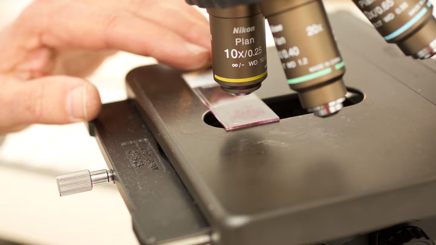 ‘Significantly delayed diagnosis’: Retired nurse dies after cancer is missed twice