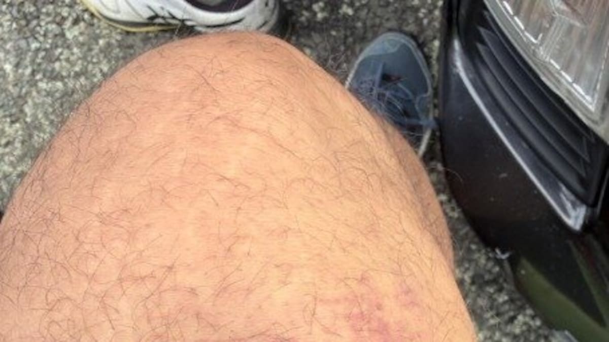 Watch: 'Smashing each other with bats': Weekend cricket game descends into violent brawl