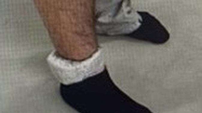 Several photos of people foiling their ankle bracelets were in the internal police report.