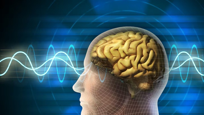 Using advanced artificial intelligence algorithms, scientists are hoping to identify brain wave patterns associated with the risk of dementia. Photo / 123RF