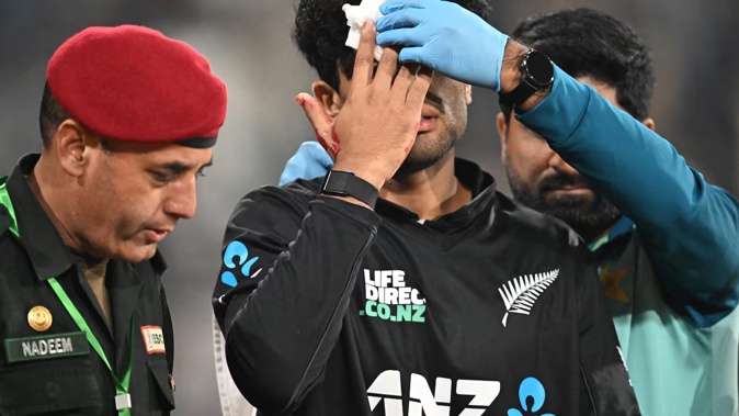 Rachin Ravindra receives medical attention after being hit on the head. Photo / AFP