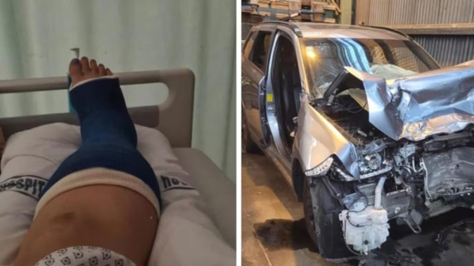 Hazel Jamieson suffered multiple fractures and significant bruising in the crash. Photo / Givealittle