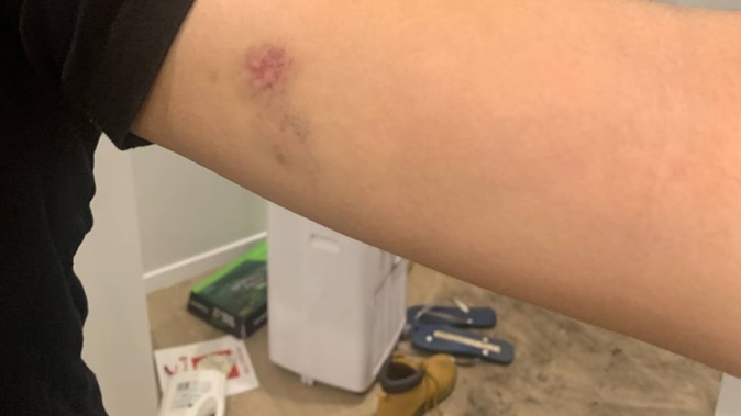 An Auckland student was injured after being robbed by offenders pretending to be police.