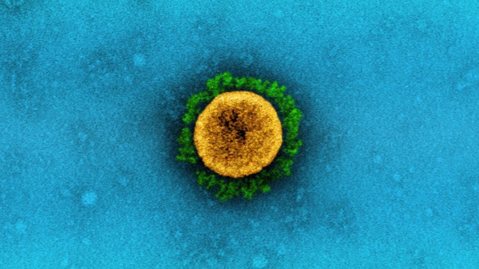 Scientists are closely tracking another fast-rising coronavirus variant - Omicron strain BN.1. Photo / NIAID