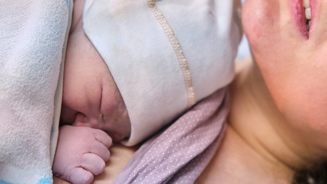 Birth injuries are covered by ACC now. Photo / 123RF