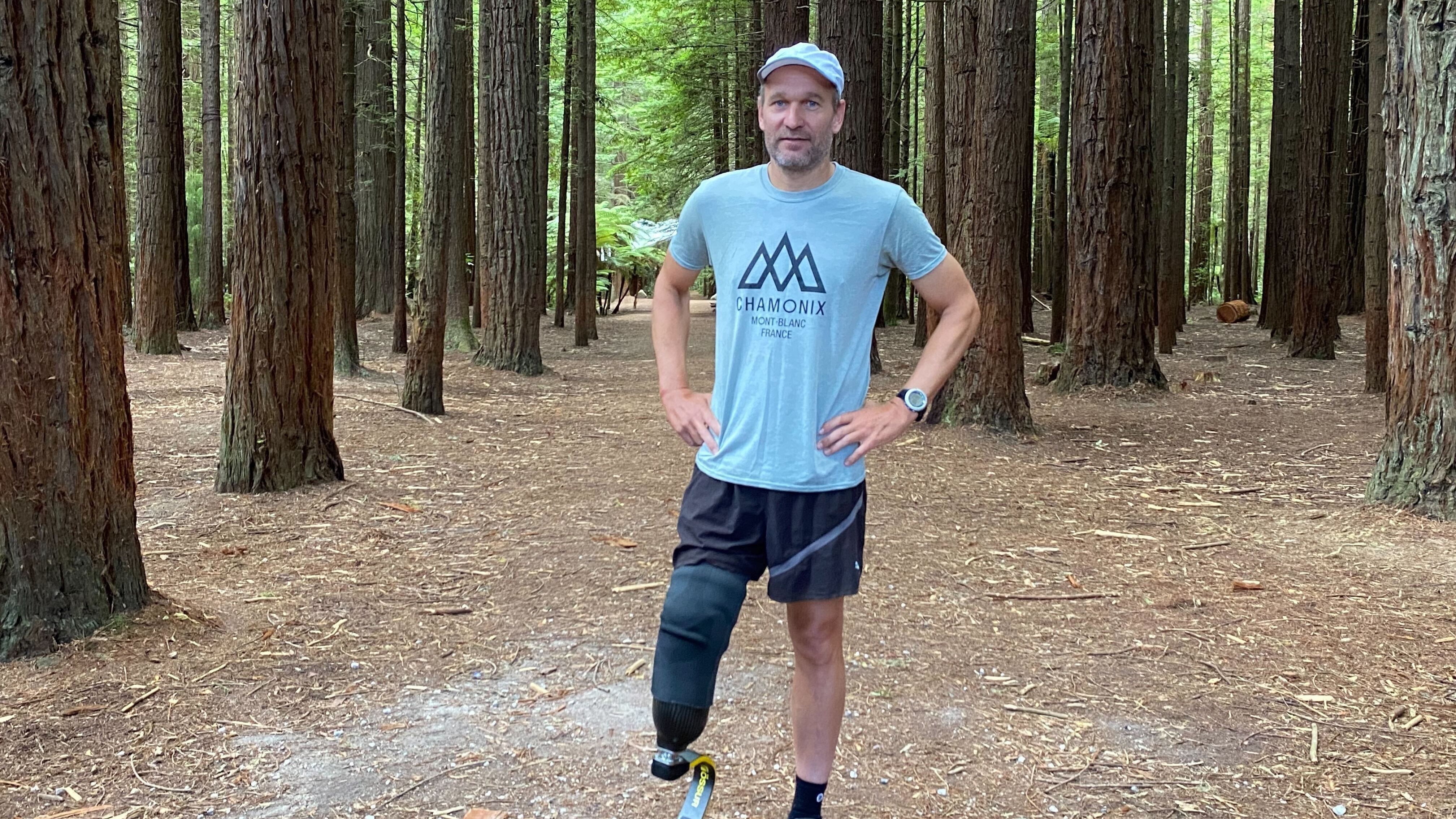 Sjors Corporaal lost his leg in an accident in May 2024 and has a prosthetic leg. Photo / Megan Wilson