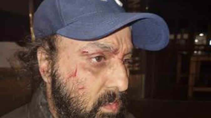 Ashpreet Singh following the attack. Photo / File