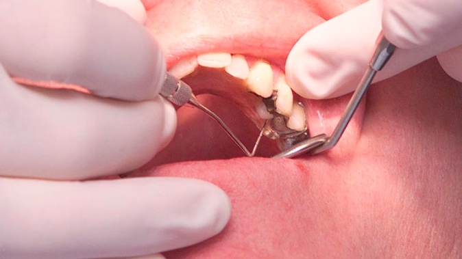 Photo / Mark Mitchell