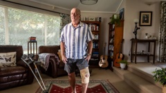 72-year-old Bob Menzies has been waiting years for a knee replacement. Photo / Michael Craig