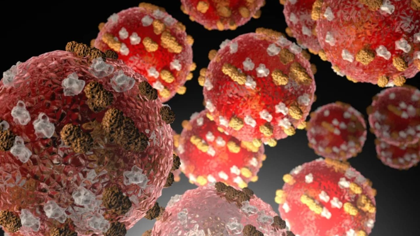 Measles cases rise to 30 as Auckland concert named location of interest