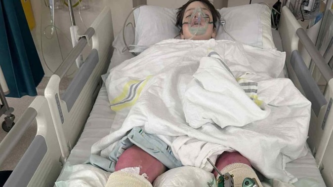Aspiring ski medic Charlie Lane suffered serious injuries after an 8m fall while skiing.