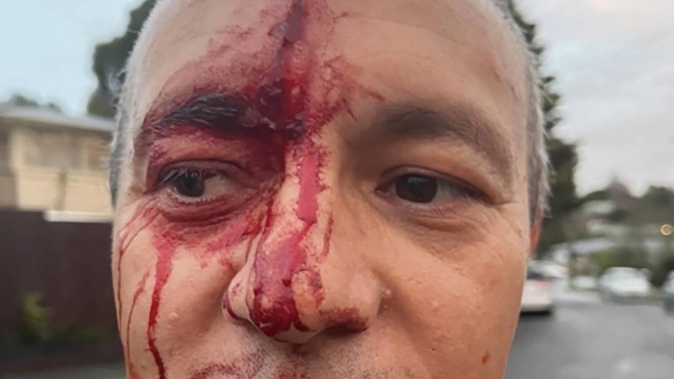 A bloodied Craig Lord after an altercation with an alleged offender. (Photo / Facebook)