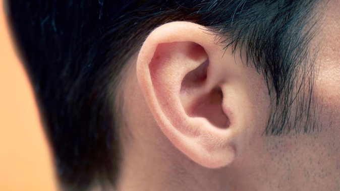 Ears are so distinctive they are as effective as DNA or fingerprints in identifying someone. Photo / Getty Images